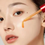 Red Acne Succinic Acid Peel 1