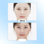 VT – Reedle Shot Lip Plumper Beginner 1