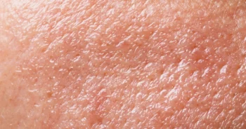 piel-grasa haciendo rutina-de skincare.