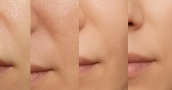 Esta imagen hace referencia a una persona que quiere conocer su tipo de piel