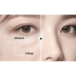 Centellian24 – Madeca Cream Tight Lifting 3