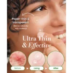 Troubless Invisible Plus Spot Patch The Red Correct