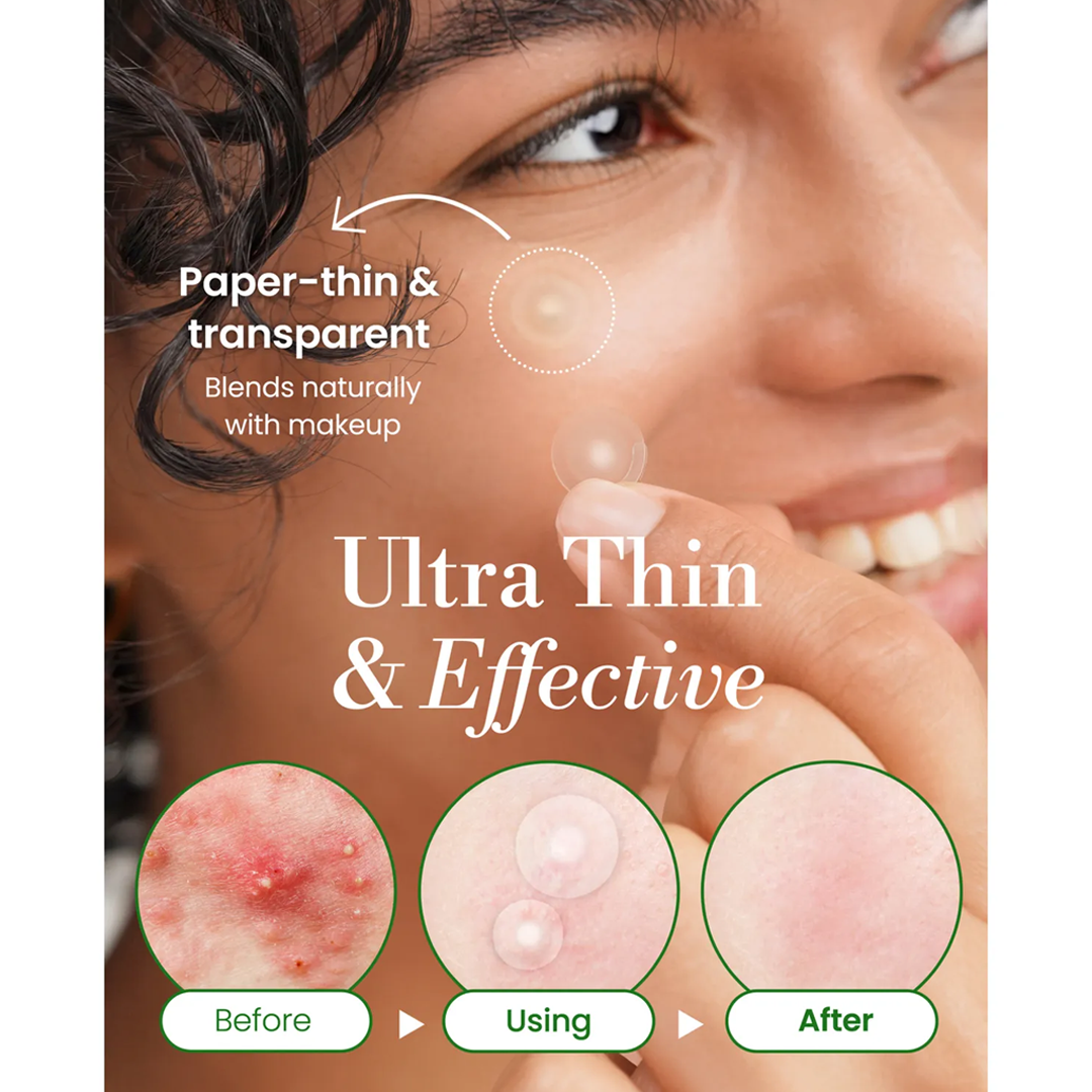 Troubless Invisible Plus Spot Patch The Red Correct 1